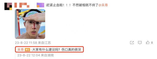 吴尊因打球导致鼻子受伤，网友：心疼尊哥三秒钟(图5)