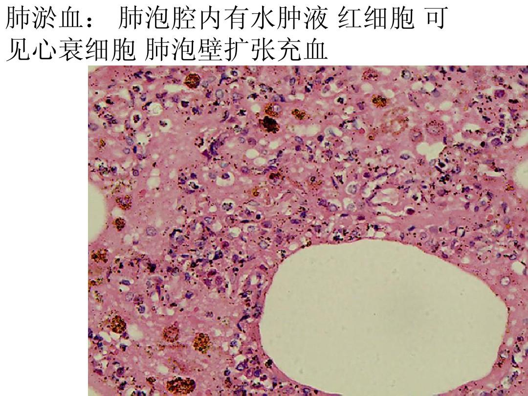 汤楠团队揭示衰老导致肺泡再生障碍的新机制(图2)