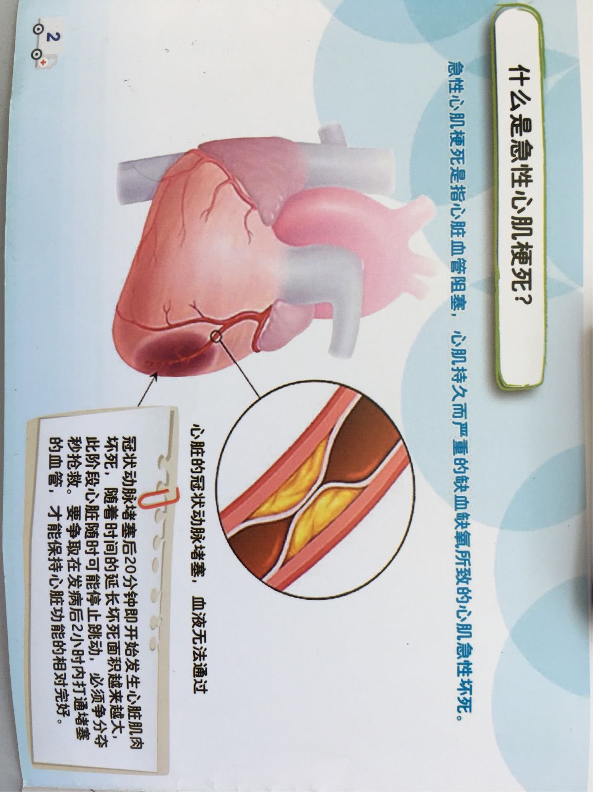 第十个“中国心梗救治日”专家提醒黄金时间窗口是120分钟(图1)