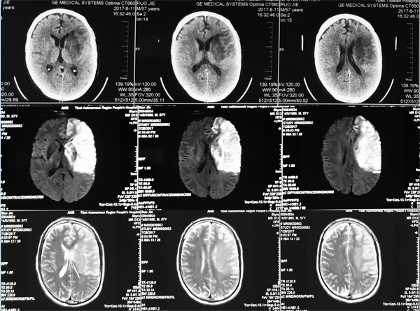 世界卫生组织将罕见病定义为患病人数占总人口0.65‰-1‰