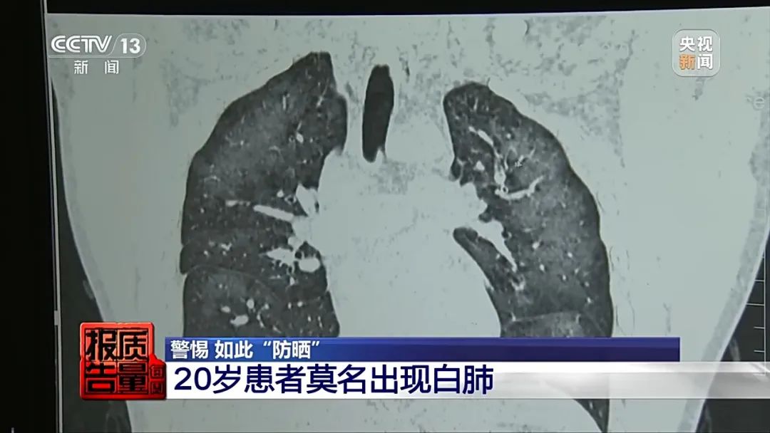 警惕！已有人白肺！福州很多人在用！